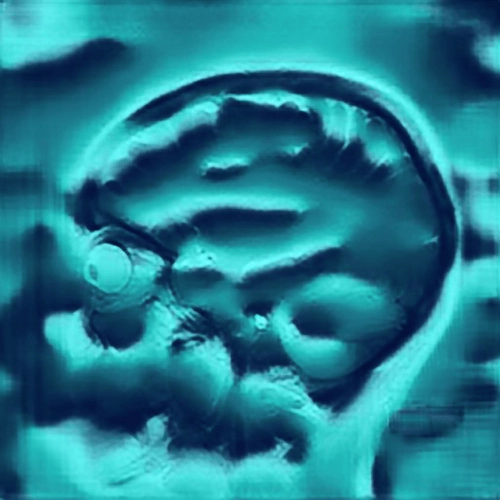 Alprazolam 3